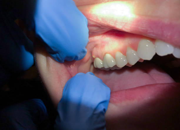 Best Emergency Dentist Near Me  in Houston, TX
